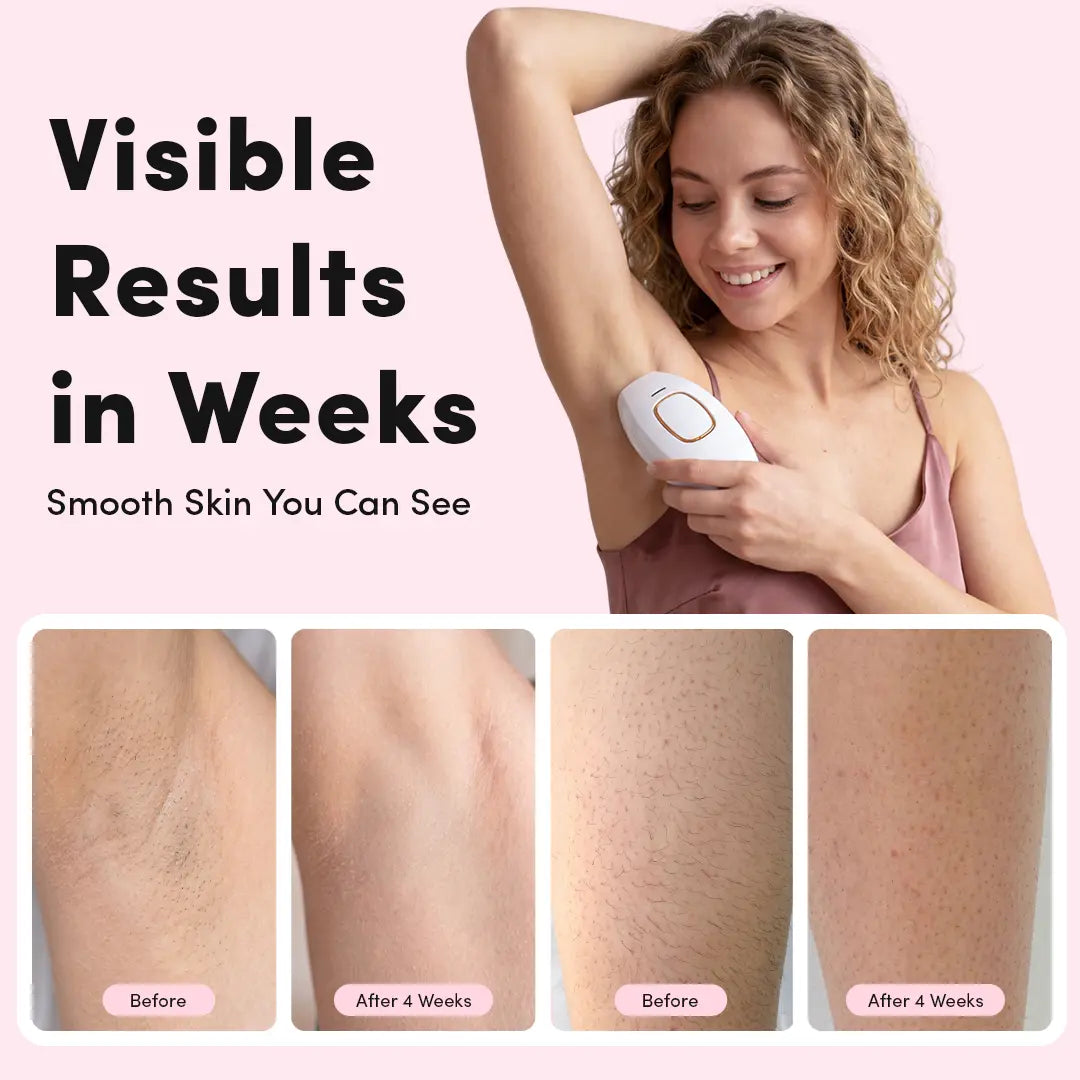 IPL Hair Removal Device - At-Home Intense Pulsed Light Handset