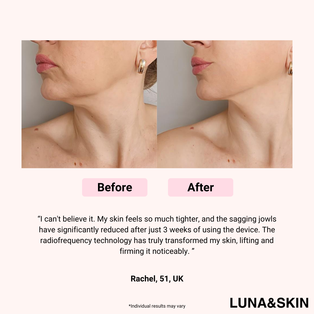 Facial Skin Care Booster Device