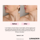 Facial Skin Care Booster Device