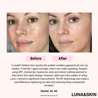 Facial Skin Care Booster Device