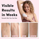 IPL Hair Removal Device - At-Home Intense Pulsed Light Handset