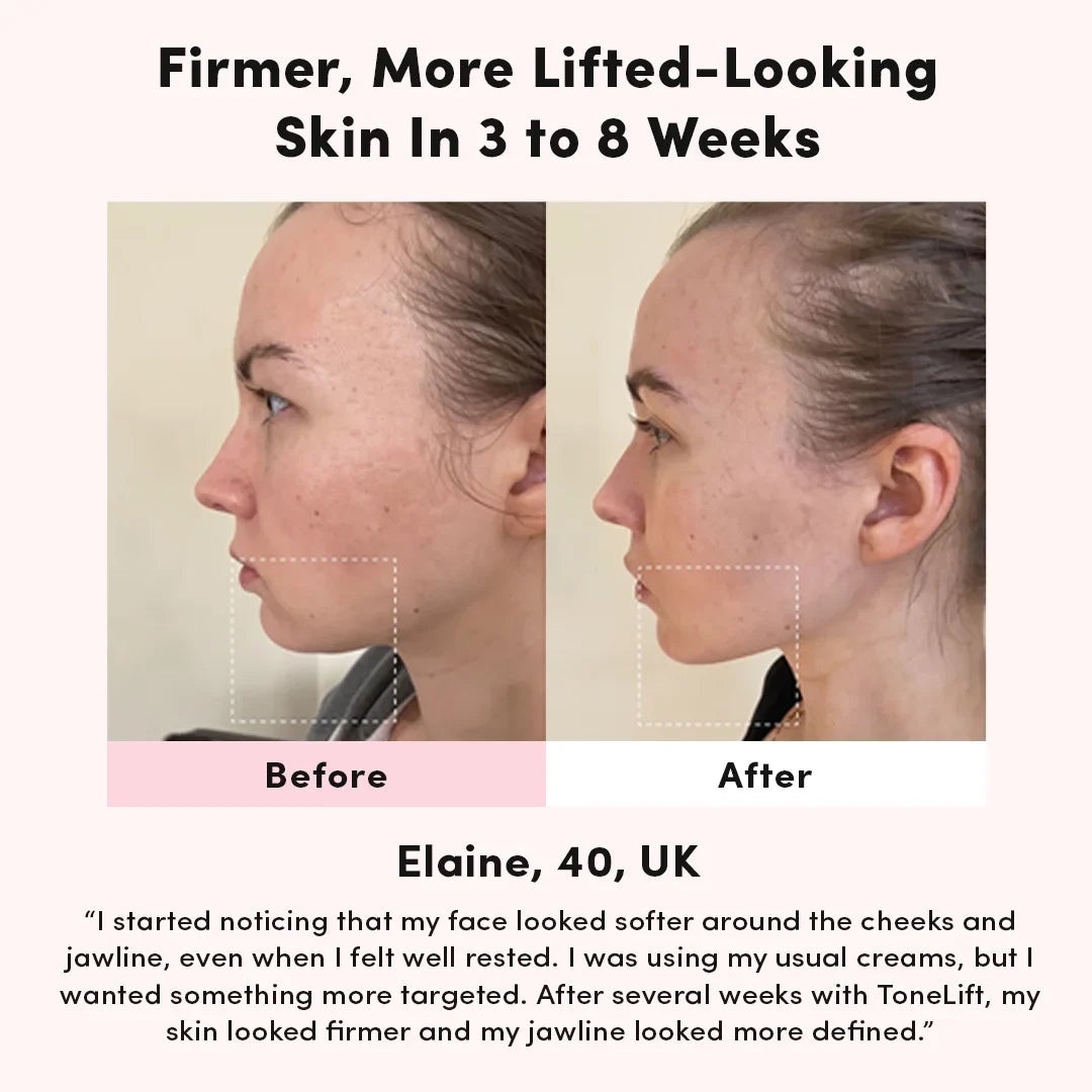 Facial Toning & Lifting Massager - Skin Tightening Beauty Device